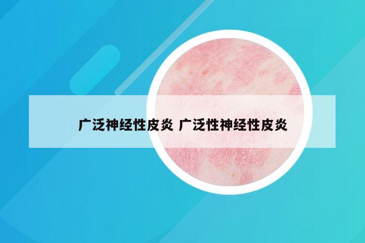 广泛神经性皮炎 广泛性神经性皮炎
