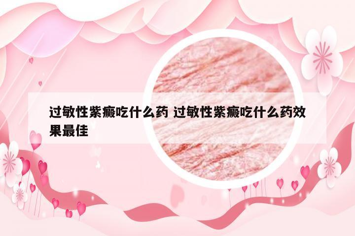 过敏性紫癜吃什么药 过敏性紫癜吃什么药效果最佳