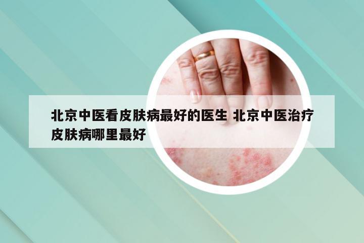北京中医看皮肤病最好的医生 北京中医治疗皮肤病哪里最好