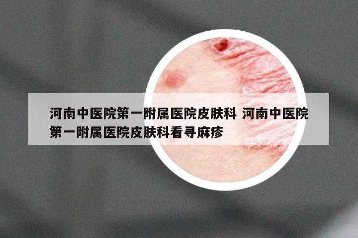 河南中医院第一附属医院皮肤科 河南中医院第一附属医院皮肤科看寻麻疹