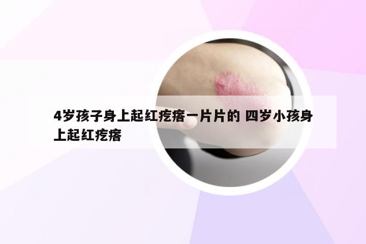 4岁孩子身上起红疙瘩一片片的 四岁小孩身上起红疙瘩