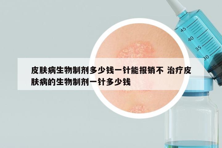 皮肤病生物制剂多少钱一针能报销不 治疗皮肤病的生物制剂一针多少钱