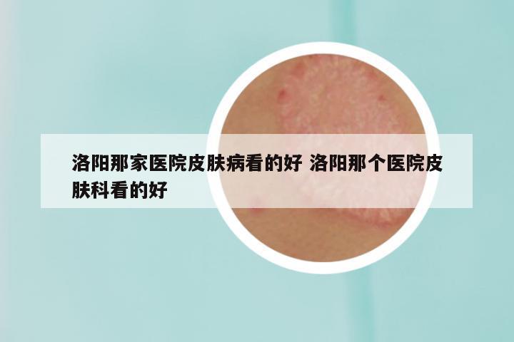 洛阳那家医院皮肤病看的好 洛阳那个医院皮肤科看的好