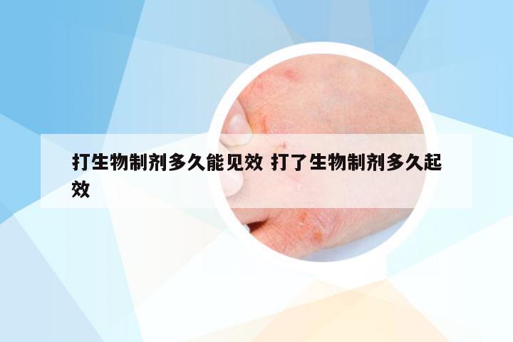 打生物制剂多久能见效 打了生物制剂多久起效