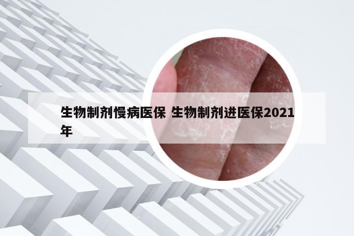 生物制剂慢病医保 生物制剂进医保2021年