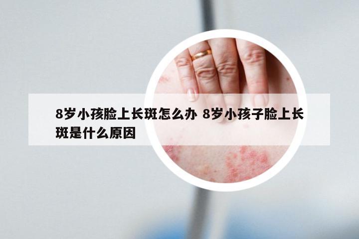 8岁小孩脸上长斑怎么办 8岁小孩子脸上长斑是什么原因