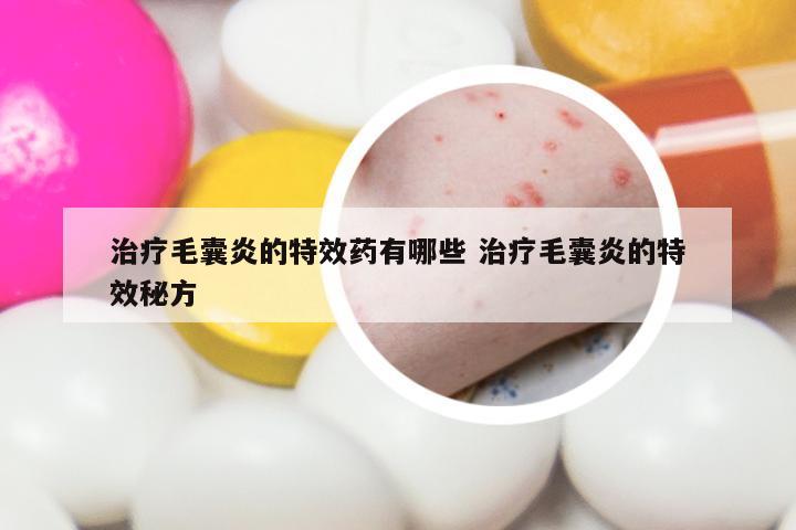 治疗毛囊炎的特效药有哪些 治疗毛囊炎的特效秘方