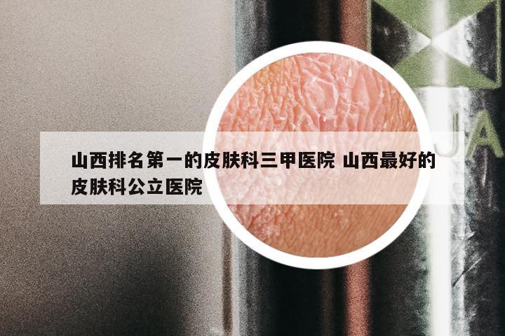 山西排名第一的皮肤科三甲医院 山西最好的皮肤科公立医院