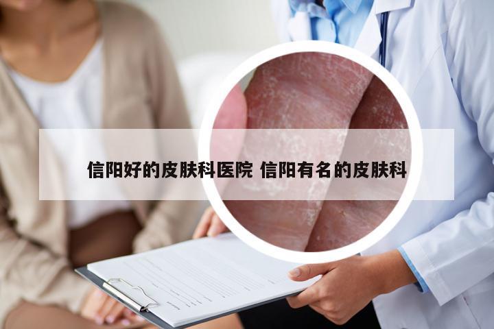 信阳好的皮肤科医院 信阳有名的皮肤科