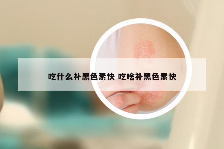 吃什么补黑色素快 吃啥补黑色素快