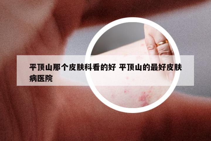 平顶山那个皮肤科看的好 平顶山的最好皮肤病医院