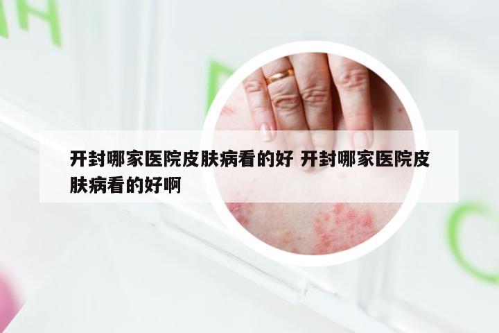 开封哪家医院皮肤病看的好 开封哪家医院皮肤病看的好啊