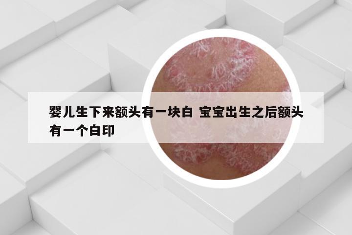 婴儿生下来额头有一块白 宝宝出生之后额头有一个白印