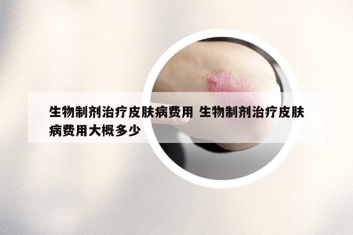 生物制剂治疗皮肤病费用 生物制剂治疗皮肤病费用大概多少