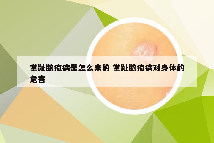 掌趾脓疱病是怎么来的 掌趾脓疱病对身体的危害