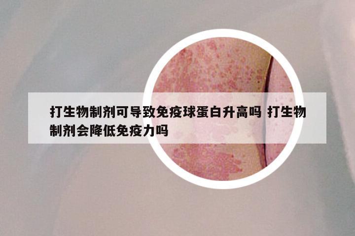 打生物制剂可导致免疫球蛋白升高吗 打生物制剂会降低免疫力吗