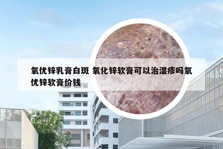 氧优锌乳膏白斑 氧化锌软膏可以治湿疹吗氧优锌软膏价钱