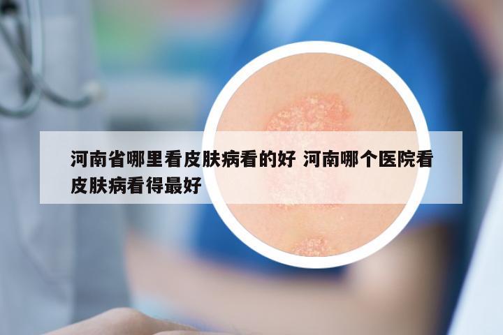 河南省哪里看皮肤病看的好 河南哪个医院看皮肤病看得最好