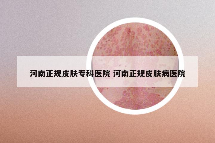 河南正规皮肤专科医院 河南正规皮肤病医院