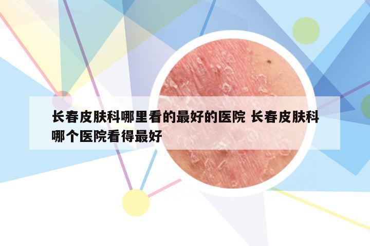 长春皮肤科哪里看的最好的医院 长春皮肤科哪个医院看得最好