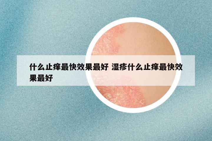 什么止痒最快效果最好 湿疹什么止痒最快效果最好