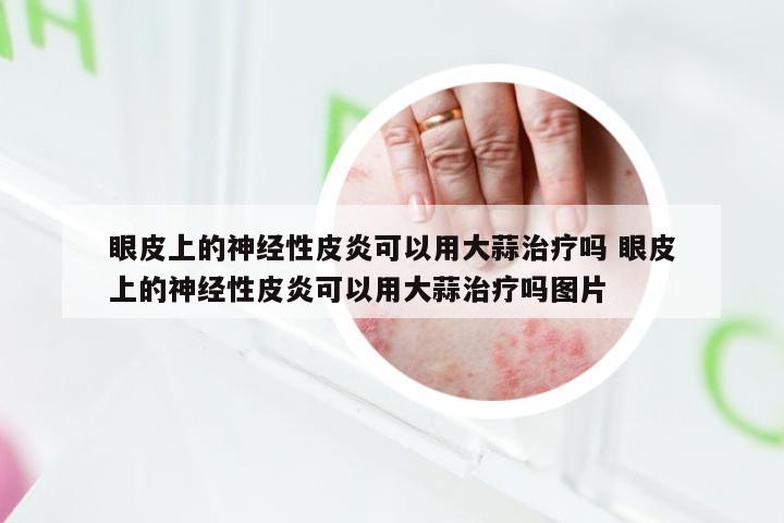 眼皮上的神经性皮炎可以用大蒜治疗吗 眼皮上的神经性皮炎可以用大蒜治疗吗图片
