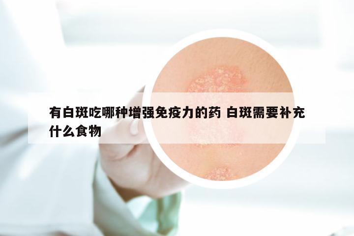 有白斑吃哪种增强免疫力的药 白斑需要补充什么食物