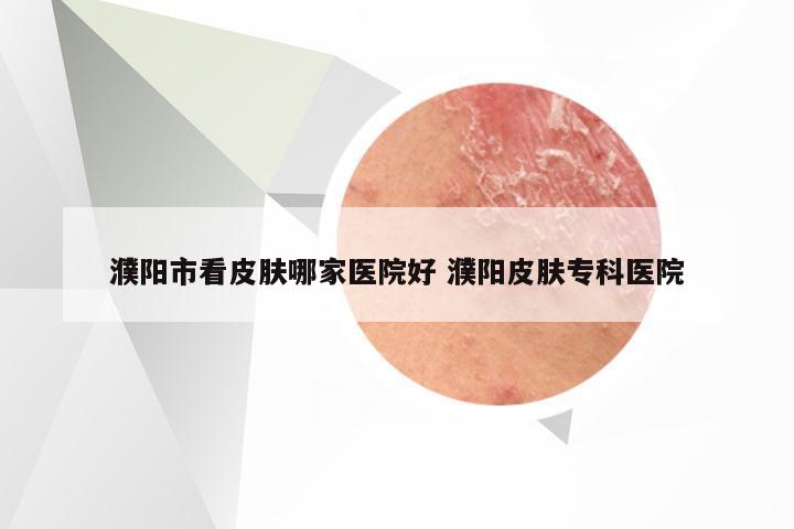濮阳市看皮肤哪家医院好 濮阳皮肤专科医院