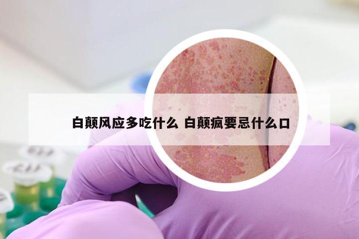 白颠风应多吃什么 白颠疯要忌什么口
