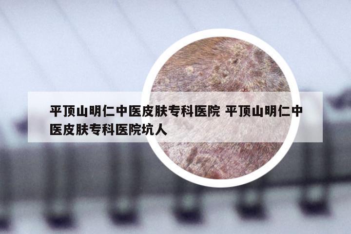平顶山明仁中医皮肤专科医院 平顶山明仁中医皮肤专科医院坑人