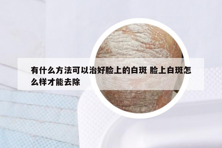 有什么方法可以治好脸上的白斑 脸上白斑怎么样才能去除