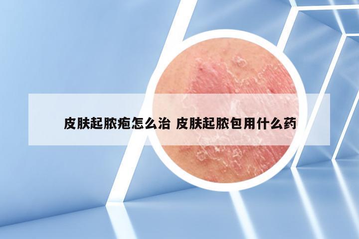 皮肤起脓疱怎么治 皮肤起脓包用什么药