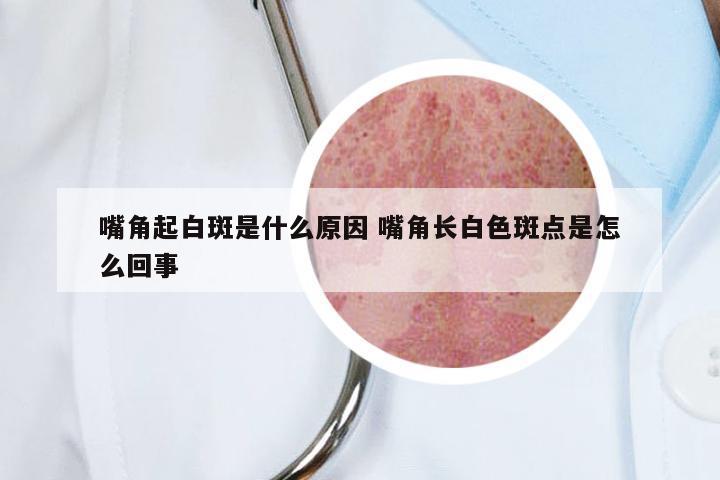 嘴角起白斑是什么原因 嘴角长白色斑点是怎么回事