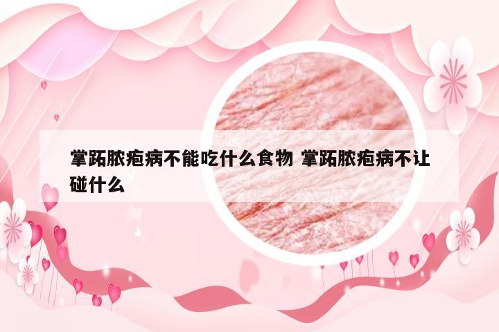 掌跖脓疱病不能吃什么食物 掌跖脓疱病不让碰什么
