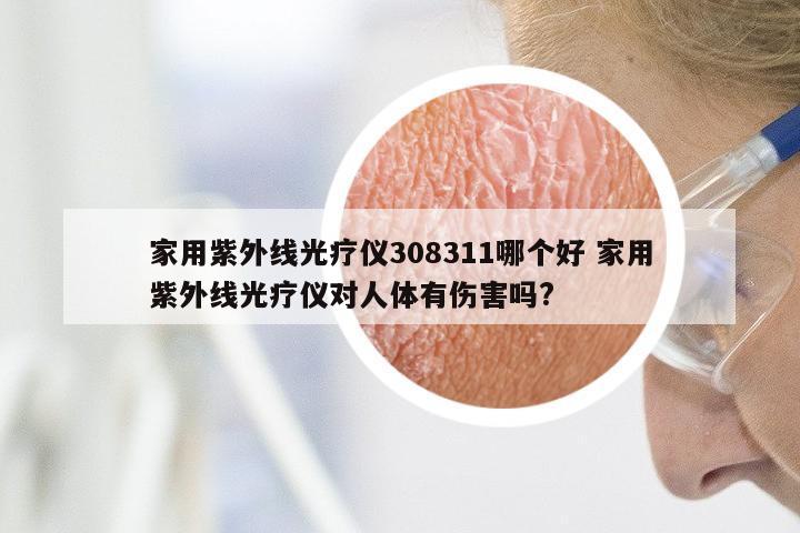 家用紫外线光疗仪308311哪个好 家用紫外线光疗仪对人体有伤害吗?