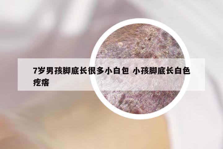 7岁男孩脚底长很多小白包 小孩脚底长白色疙瘩