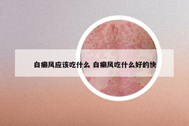 白癞风应该吃什么 白癞风吃什么好的快