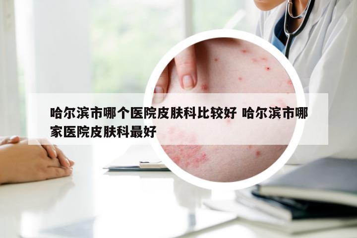 哈尔滨市哪个医院皮肤科比较好 哈尔滨市哪家医院皮肤科最好