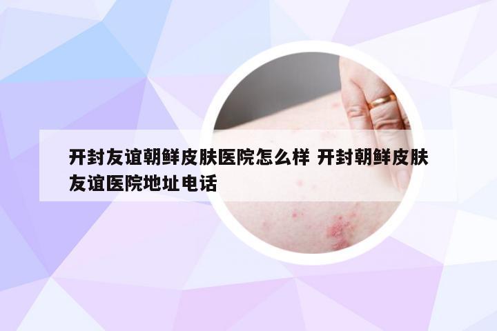 开封友谊朝鲜皮肤医院怎么样 开封朝鲜皮肤友谊医院地址电话