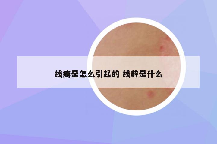 线癣是怎么引起的 线藓是什么