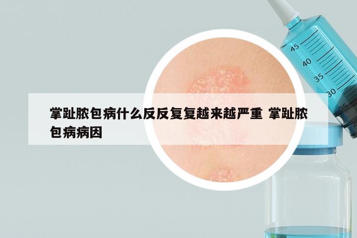 掌趾脓包病什么反反复复越来越严重 掌趾脓包病病因