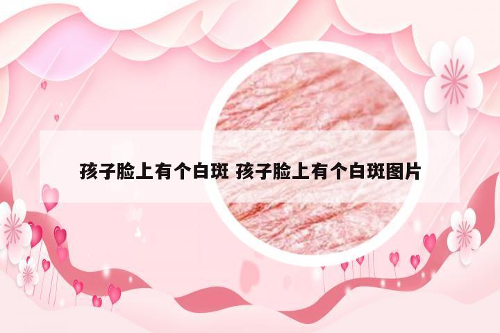 孩子脸上有个白斑 孩子脸上有个白斑图片