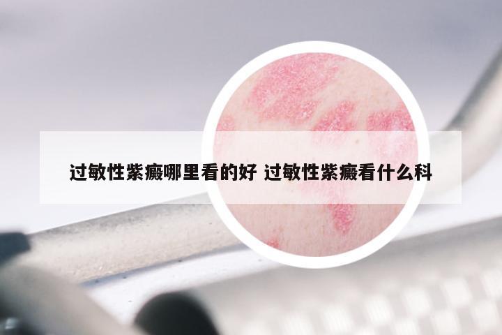 过敏性紫癜哪里看的好 过敏性紫癜看什么科