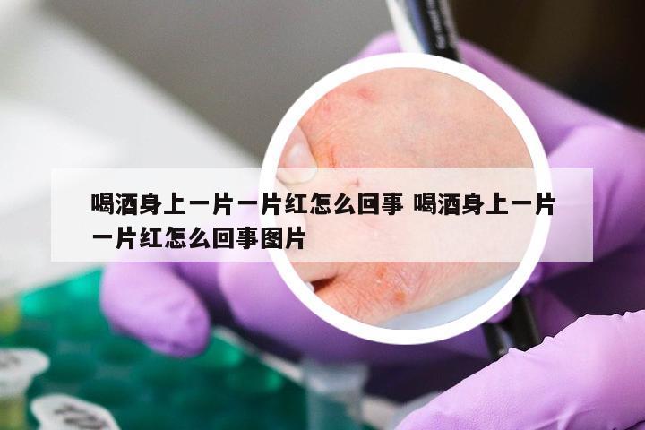 喝酒身上一片一片红怎么回事 喝酒身上一片一片红怎么回事图片