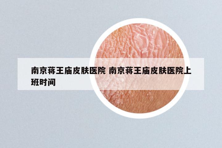 南京蒋王庙皮肤医院 南京蒋王庙皮肤医院上班时间