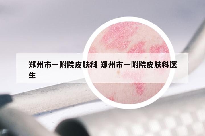 郑州市一附院皮肤科 郑州市一附院皮肤科医生