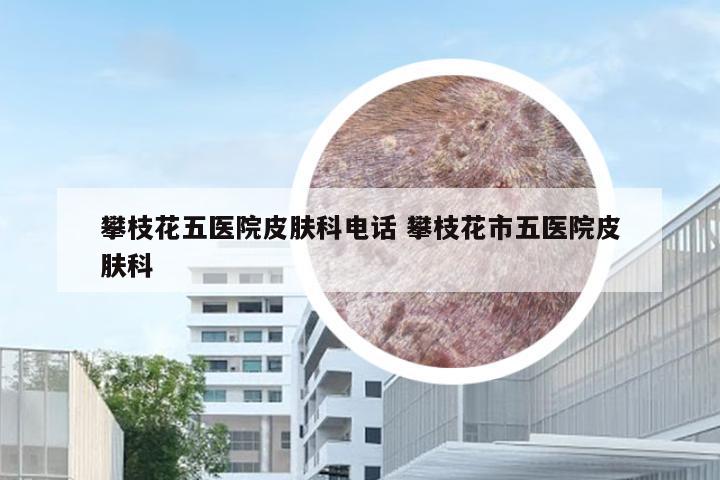 攀枝花五医院皮肤科电话 攀枝花市五医院皮肤科