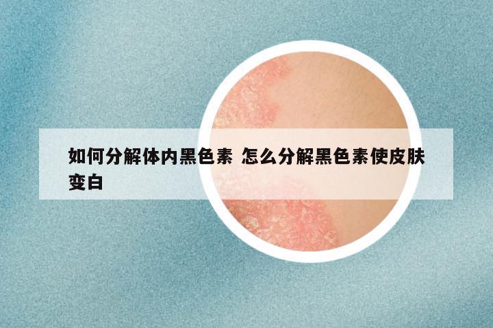 如何分解体内黑色素 怎么分解黑色素使皮肤变白