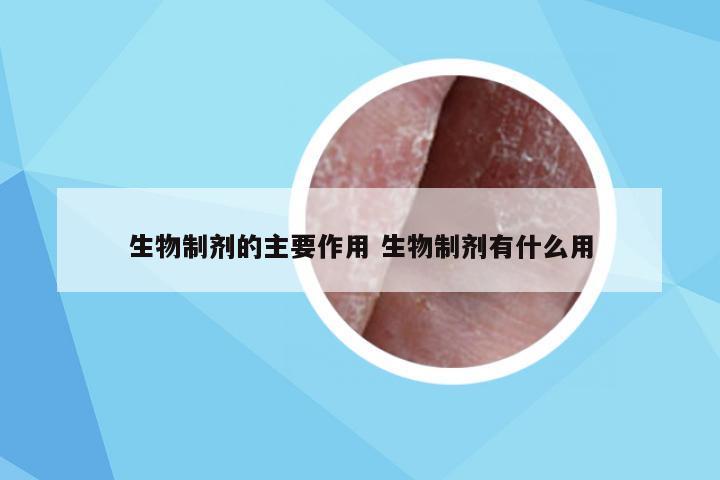 生物制剂的主要作用 生物制剂有什么用