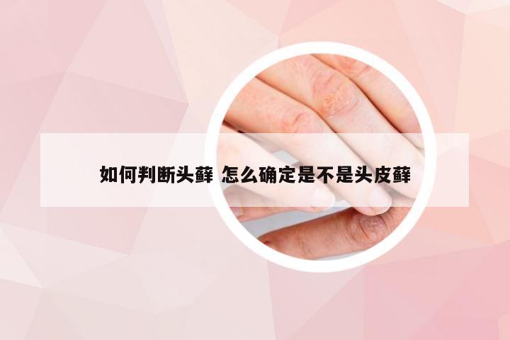 如何判断头藓 怎么确定是不是头皮藓